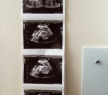 Scan